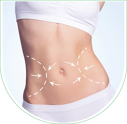 Abdominoplastie et liposuccion du ventre en Tunisie via Chantal Denis