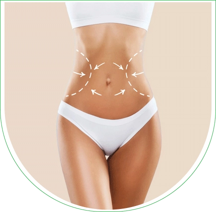 BodyTite + Quantum RF