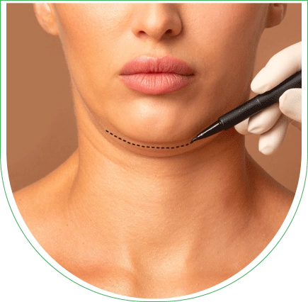 Chirurgie du menton en galoche