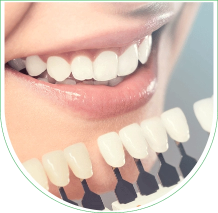 Facettes dentaires en Tunisie