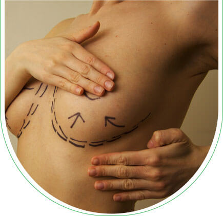 Redrapage mammaire en Tunisie via Chantal Denis