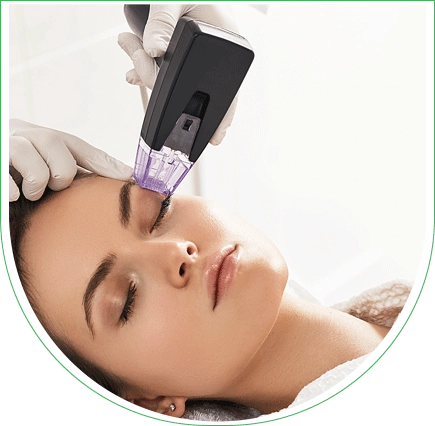 Morpheus8 en Tunisie