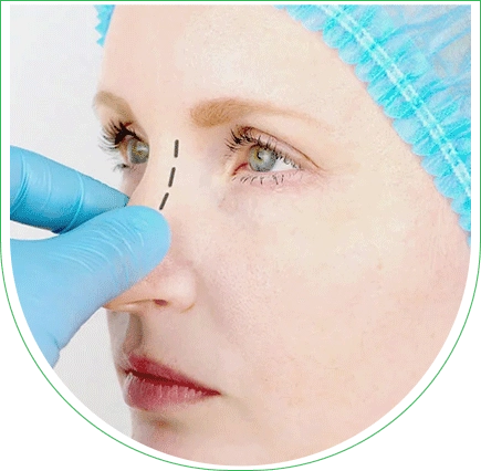 Septoplastie en Tunisie